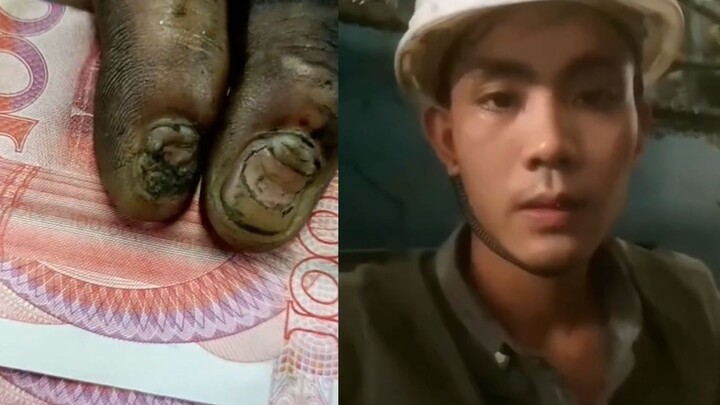A young man spent six years paying off 650,000 yuan in debt, working 12 hours a day until he was dre