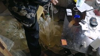 أنا في المرحلة المتأخرة من داء اليوريمية. أحمل معي شريط غسيل الكلى ليوم كامل، وأستمر في تنظيفه بعد ا