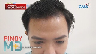 Ano ang solusyon sa labis na paglalagas at pagnipis ng buhok? | Pinoy MD