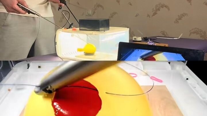 Dokter bedah membuktikan kemampuannya: menjahit sebuah balon tanpa membuatnya meledak