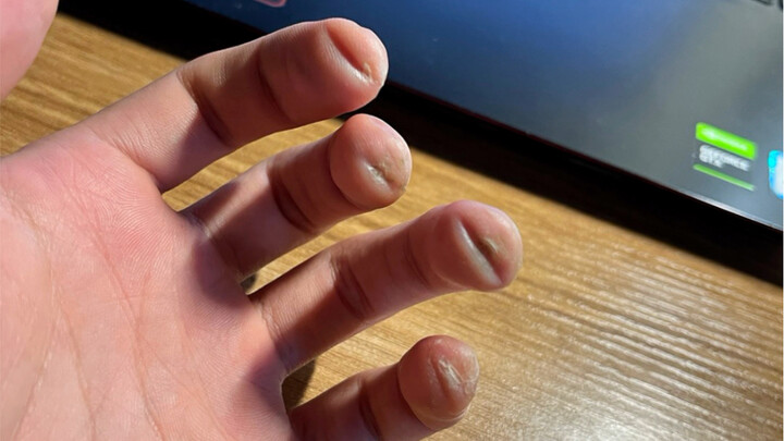 Guitarist's Medal