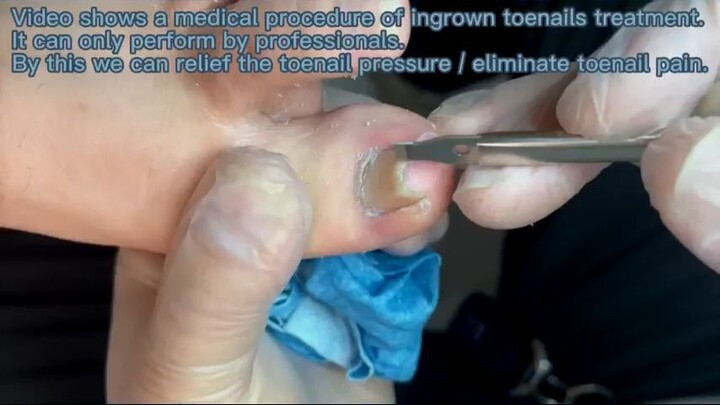Pedicure Tutorial  Arched Toenail treatment_R