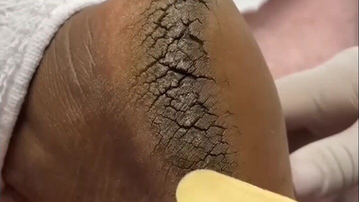 Immersive heel pedicure, you can tell from the beginning that it is very challenging...
