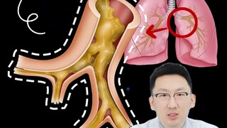 Where does the phlegm that you can’t cough up for a long time go? It may block your trachea...