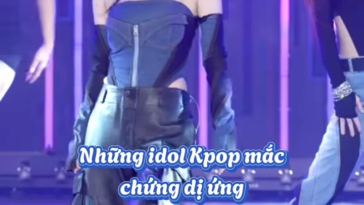 Những idil kpop mắc chứng dị ứng hiếm gặp