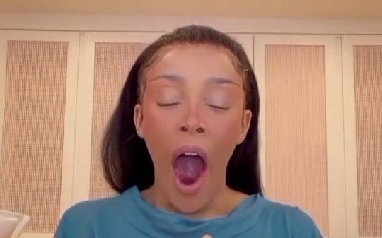 Everyone keeps saying this dog looks just like Doja Cat—but I didn’t think so at first, until I turn