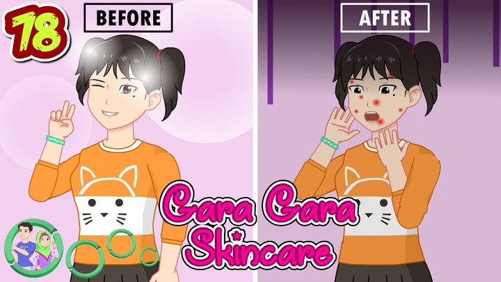 Gara Gara Skincare - Efek Memakai Skincare Murah - Jamal Laeli Remaja - Dolant Kreatif