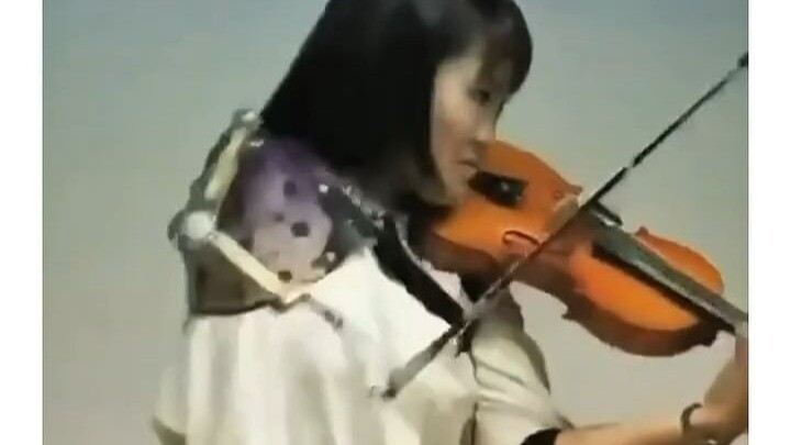 A Violinist Who Performs with a Prosthetic Limb
