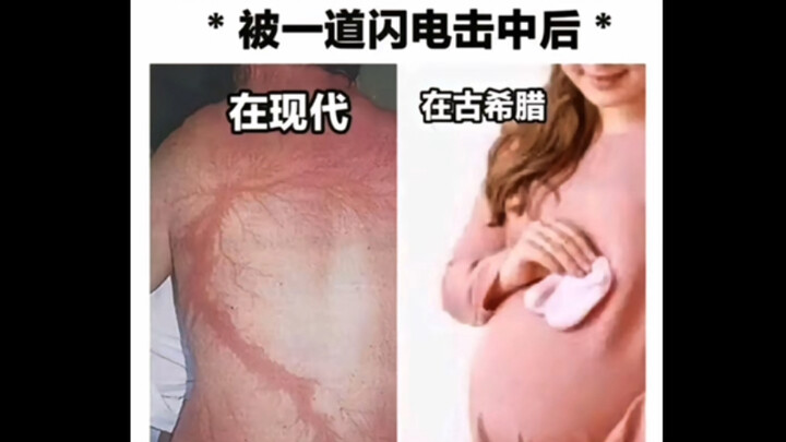 ภาพมีมขำๆ | เทพกรีกโบราณผู้เชี่ยวชาญเรื่องการตั้งครรภ์นอกมดลูก