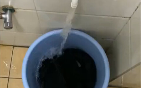 แพทย์: ทำไมคุณถึงเป็นโรคน้ำกัดเท้าได้ล่ะ?