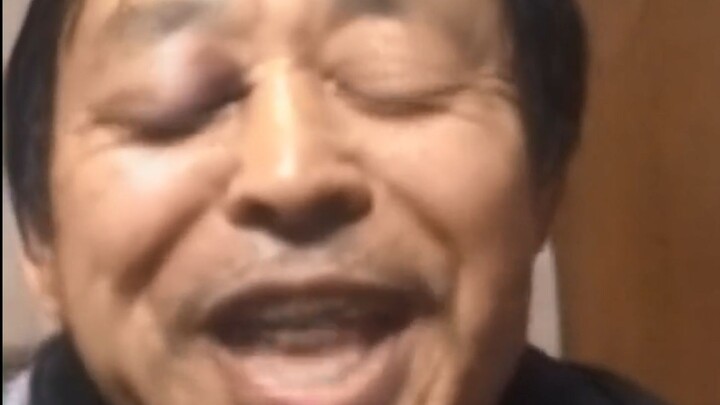 Ma Baoguo passionately sings “UNRAVEL” after getting his eye swollen from a punch.