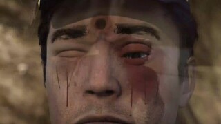 Anh ấy bị bắn một phát vào đầu nhưng không chết và để lại một vết lõm do đạn.