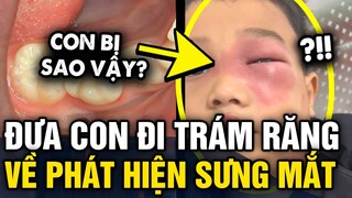 Đi trám răng về bé trai BỖNG SƯNG MẮT, đi bệnh viện khám mới TÁ HỎA vì nhiễm trùng máu | Tin 3 Phút