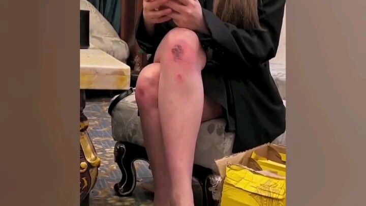 Silly hilarious comment: Only when you grow up do you realize that a scraped knee isn’t always from 