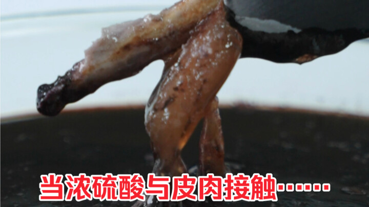 What happens when concentrated sulfuric acid comes into contact with skin?