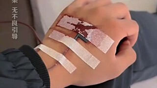 男子陪兄弟输液，却对输液管起了兴趣，网友：看样子是真兄弟！！！