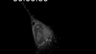 Label-free live cell imaging of apoptosis of T685A human melanoma cancer cell