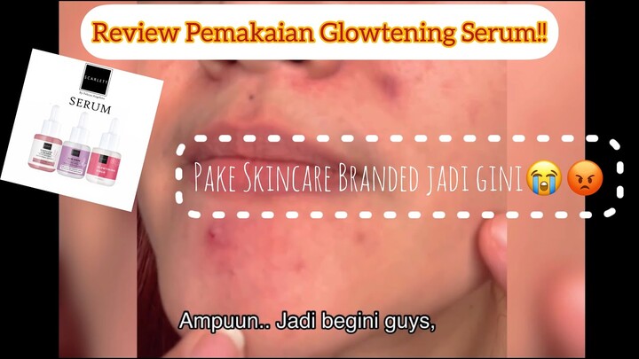 Scarlett Whitening Glowtening Serum REVIEW