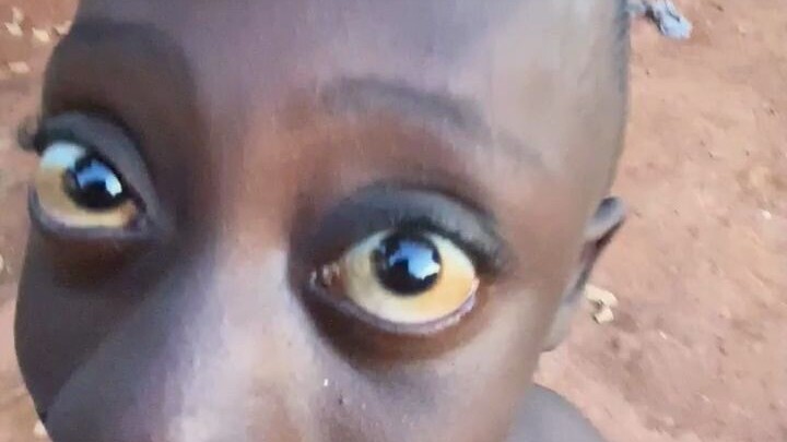 Testicle⚡-level⚡ luck⚡ lens