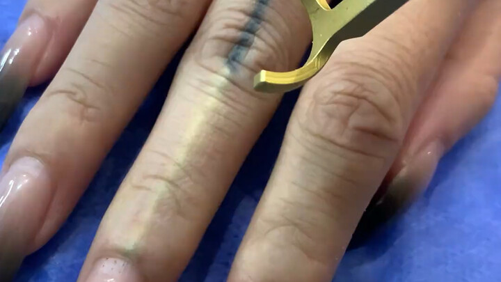 Xăm hình đường chỉ tôm