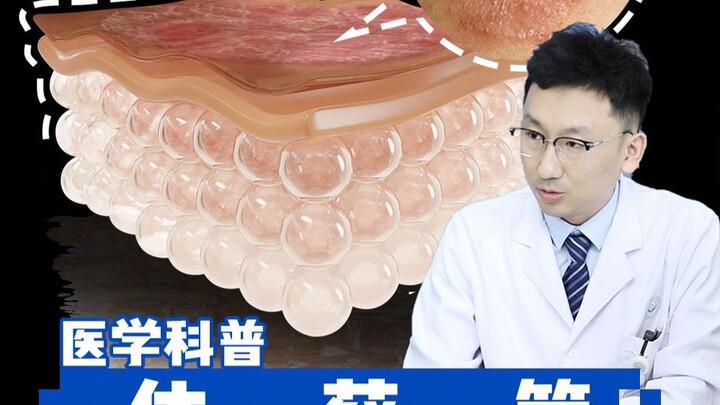 Bercak merah berbentuk bulat di tubuh bukan eksim, melainkan penyakit menular! Waspadalah, anak-anak