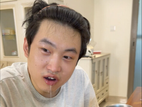 Hurry up and get your friends to watch the toothless appetite challenge