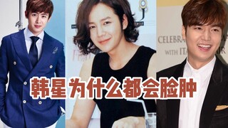 韩星为什么都会脸肿
