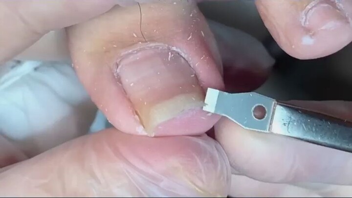 Pedicure Tutorial  Arched Toenail trimming_R
