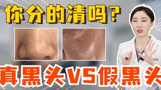 Real blackheads vs. fake blackheads—can you tell the difference?