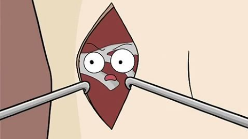 They Made A New Ear From His Rib(480P)