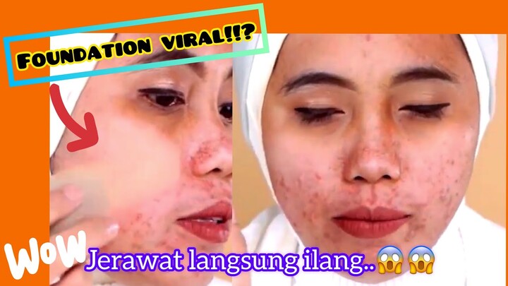 Dengan cara ini jerawat hilang dengan Lumecolors