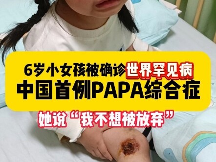 Penyakit fisik tidak bisa menghapus kecintaan kita pada kehidupan. Mari kita tetap berpegang pada ke