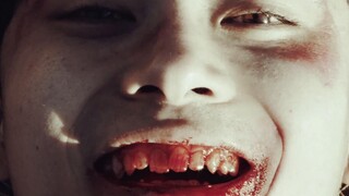 少年们才不需要什么BANDAGE 😈