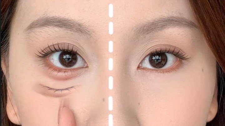 AI Image Enhancement Episode 1 | The Undereye Bag Magic—Creating Something from Nothing!