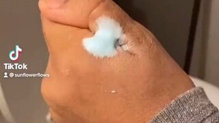 简单小实验证明：上完厕所冲屁屁，比用卫生纸处理得更干净