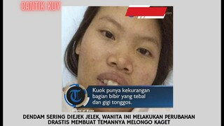 Viral Jelek Jadi Cakep Banget Karena Sering Di Ejek