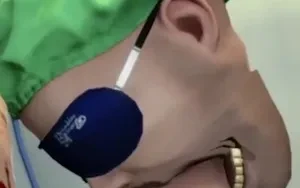 ลั่นหมอเถื่อน 5555
