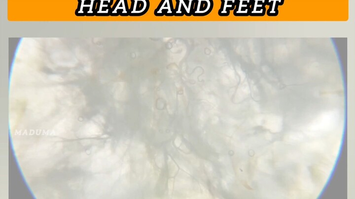 Small weapons in The Head and Feet