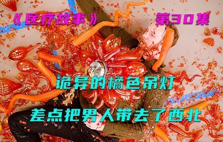 เรื่องเล่าทางการแพทย์—โคมระย้าสีส้มประหลาดเกือบพาชายคนนี้ไปทางตะวันตกเฉียงเหนือ!