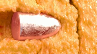 Karena kegemukan menyelamatkan nyawanya