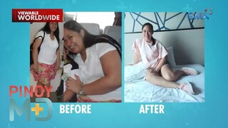 Ligtas at mabisang paraan ba ng pagbabawas ng timbang ang ‘No Sugar, No Carbs’ diet? | Pinoy MD
