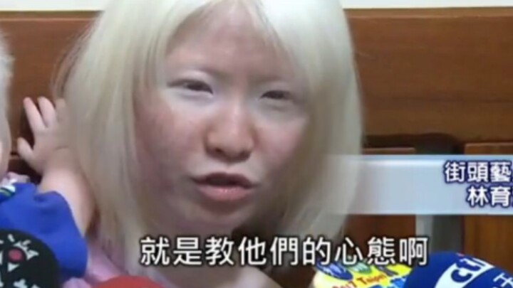 A couple from Taiwan with albinism, defying societal norms, have two sons who also have albinism.