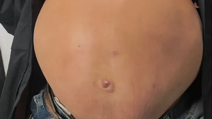 Saudara Perut Besi, perut besar yang sepenuhnya terdiri dari otot