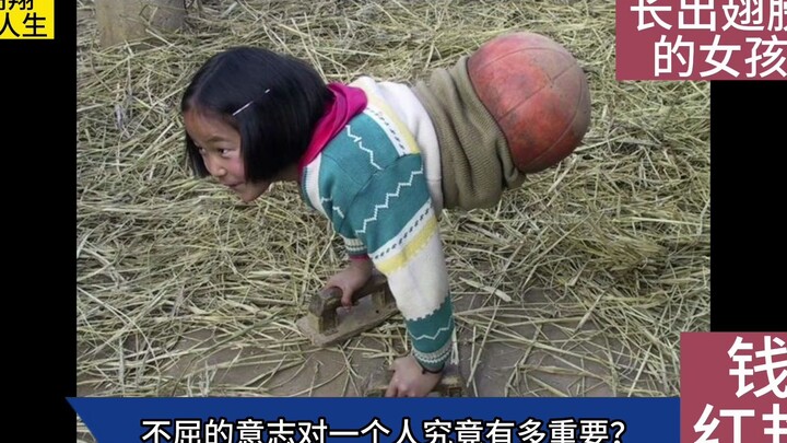 23 years ago, the “basketball girl” who lost both legs and relied on a basketball to get around has 