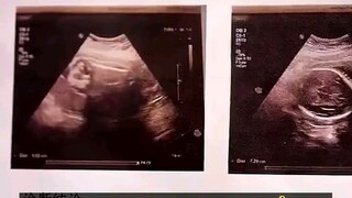 ลูกในท้องคือศักดิ์ศรีสุดท้ายของฉัน