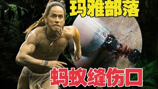 古老部落用蚂蚁的钳子缝合伤口