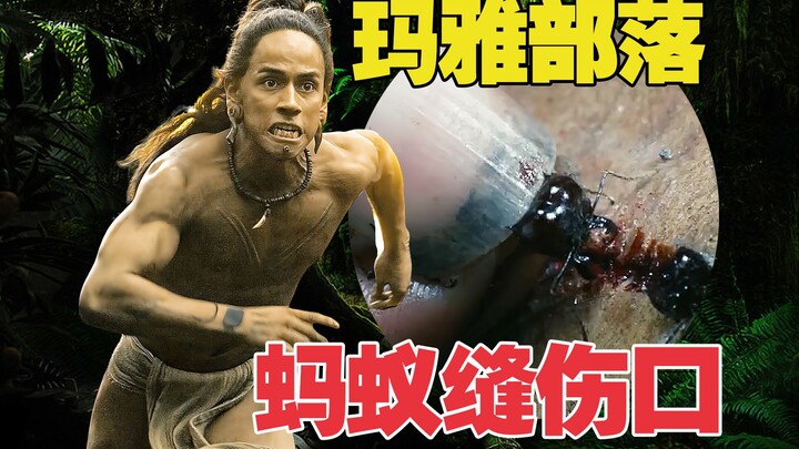 Suku kuno menggunakan rahang semut untuk menjahit luka