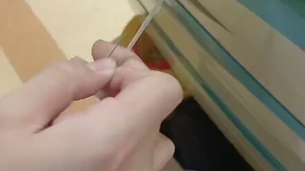 Damn, this acupuncture requires some knowledge.