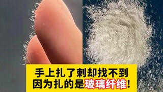 [Khoa học Phổ thông] Bị sợi thủy tinh đâm vào người đau đớn vô cùng. Khó tìm thấy kim, và không thể 
