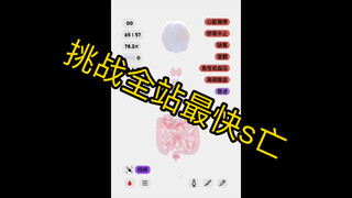 【生命life】挑战全站最快s亡 一针腺苷直接“风平浪静”